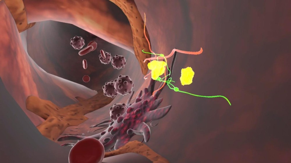 Colon VR-Prevention Lab: in Lombardia la realtà virtuale entra nella prevenzione del tumore al colon-retto